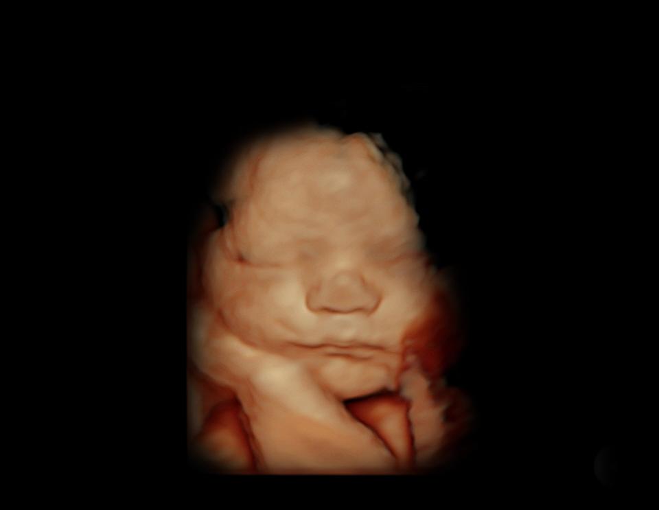 4D Ultrasound Nashville, private ultrasound Nashville, Ultrasound near me