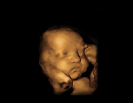 4D Ultrasound Nashville, private ultrasound Nashville, Ultrasound near me